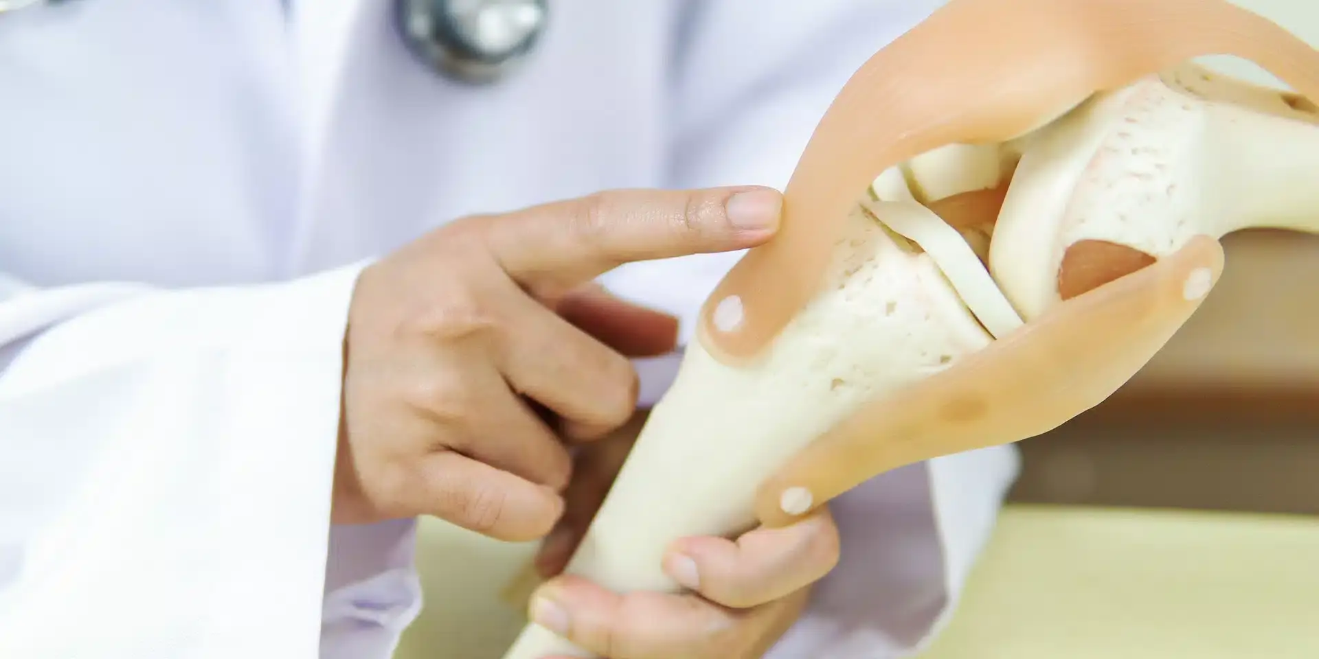 Blog - Como o condrossarcoma é diagnosticado